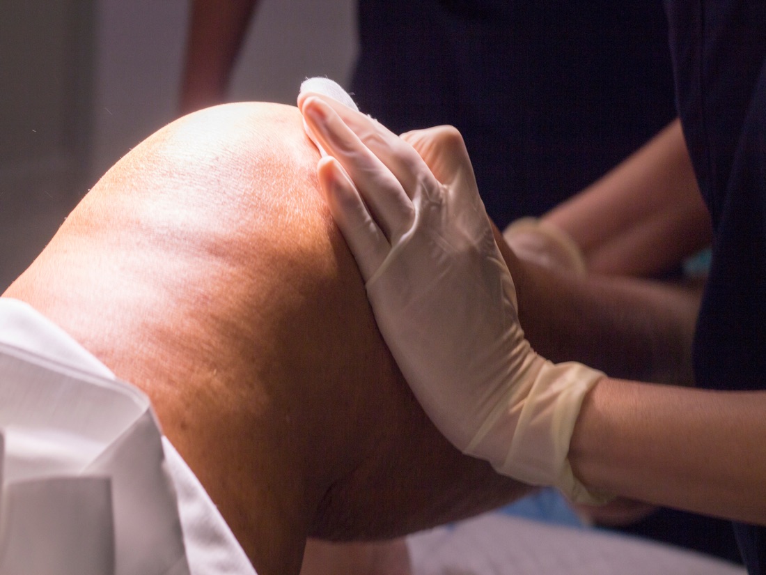 Why Post-Operative Physiotherapy is Vital for Long-Term Health