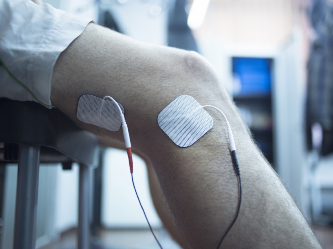 Top 5 Benefits of Physiotherapy